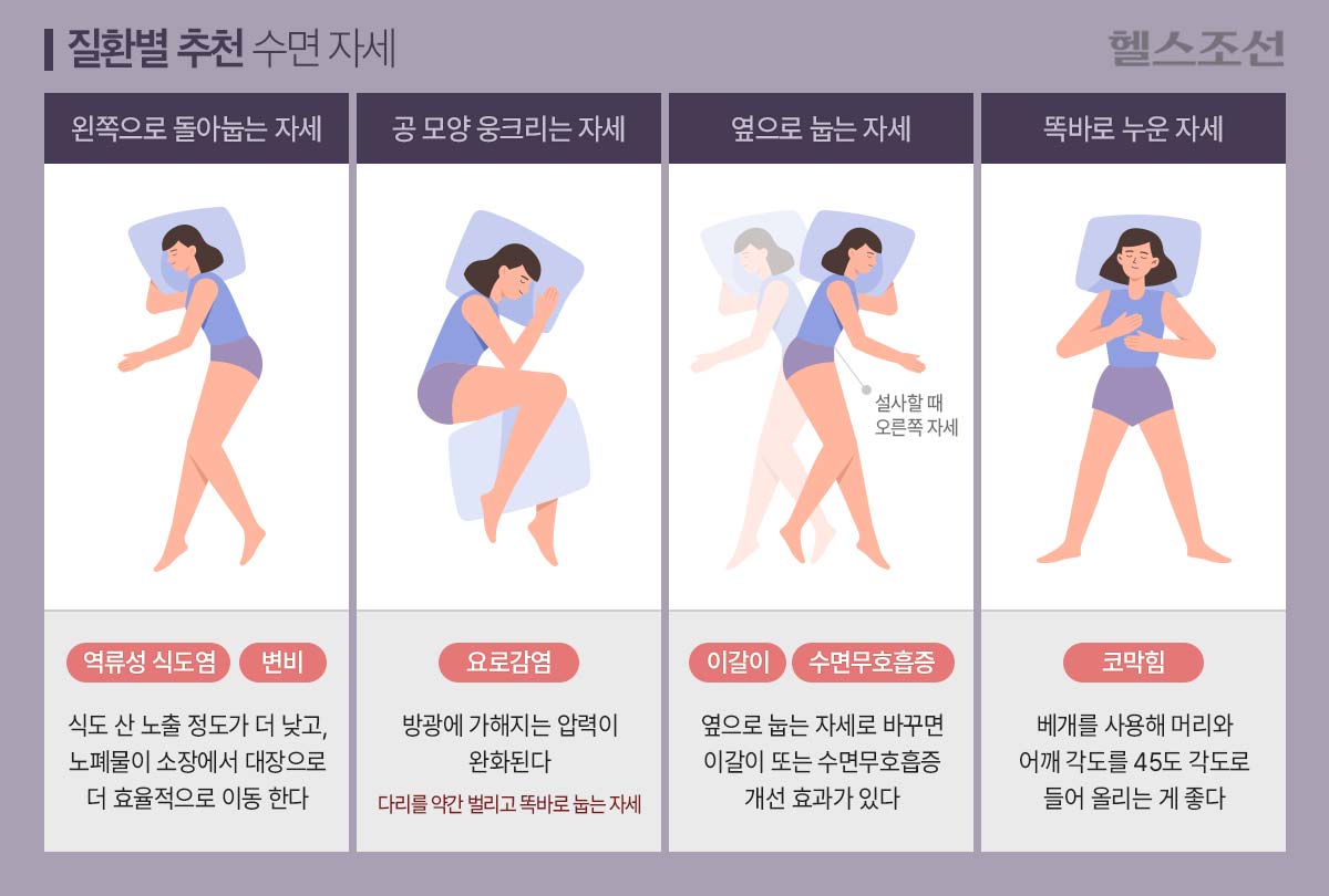 역류성 식도염 목 이물감&amp;#44; 가래가 낀 것처럼 느껴지는 이유