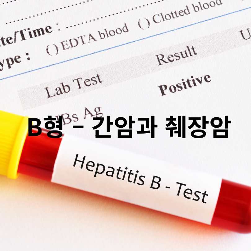 혈액형 따라 잘 생기는 암 종류