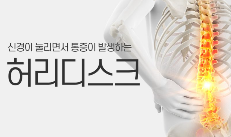 허리디스크 증상 1