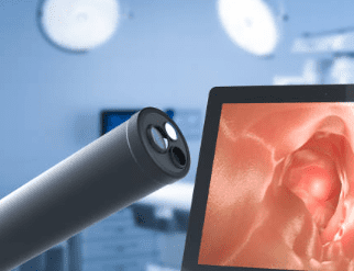 대장내시경 전 음식 주의사항과 대장내시경 약 복용법