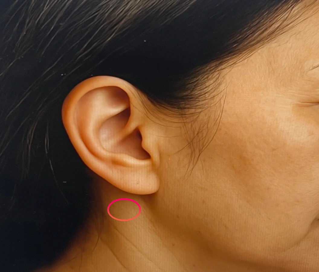 컨디션케어-밸런스-관리-시-붙이는법