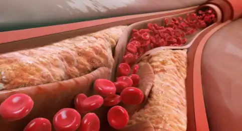 혈관-단면도-이미지