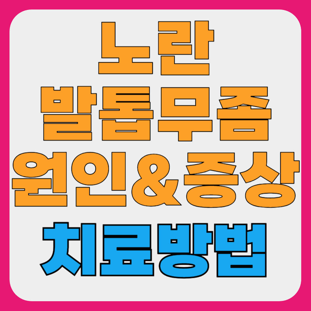 노란 발톱무좀 이유, 치료 방법