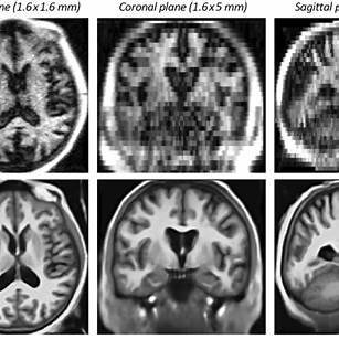 숲 속 걷기가 뇌 기능에 미치는 영향: 일본 신린요쿠(森林浴) 연구 결과