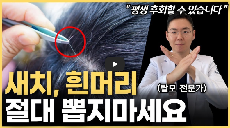 흰머리 뽑으면 안되는 이유!