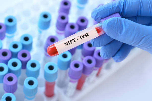 NIPT 테스트