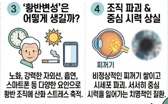 황반변성 증상
