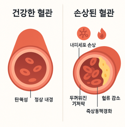혈관 건강 비교 이미지