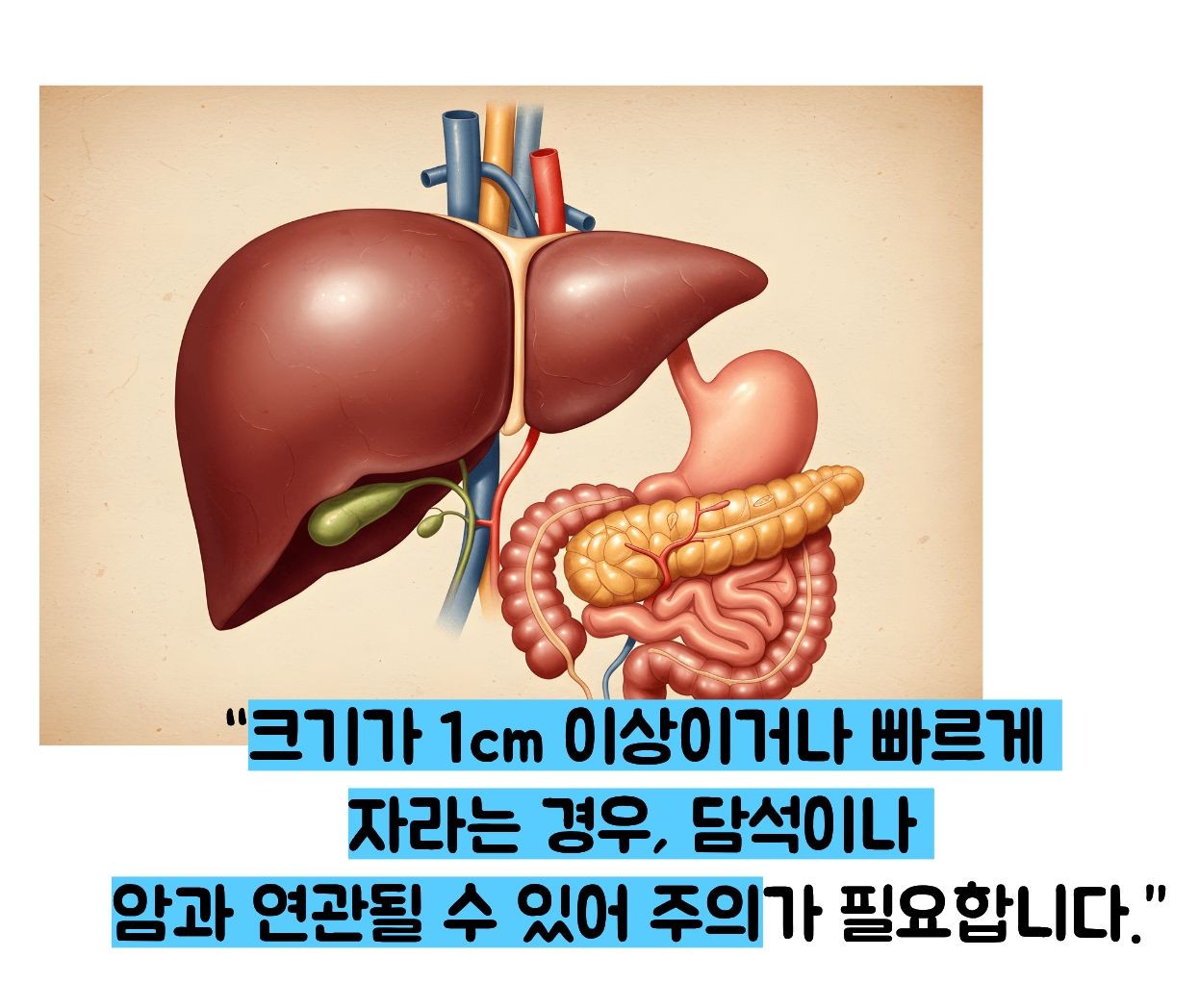 담낭 용종 줄이는 방법