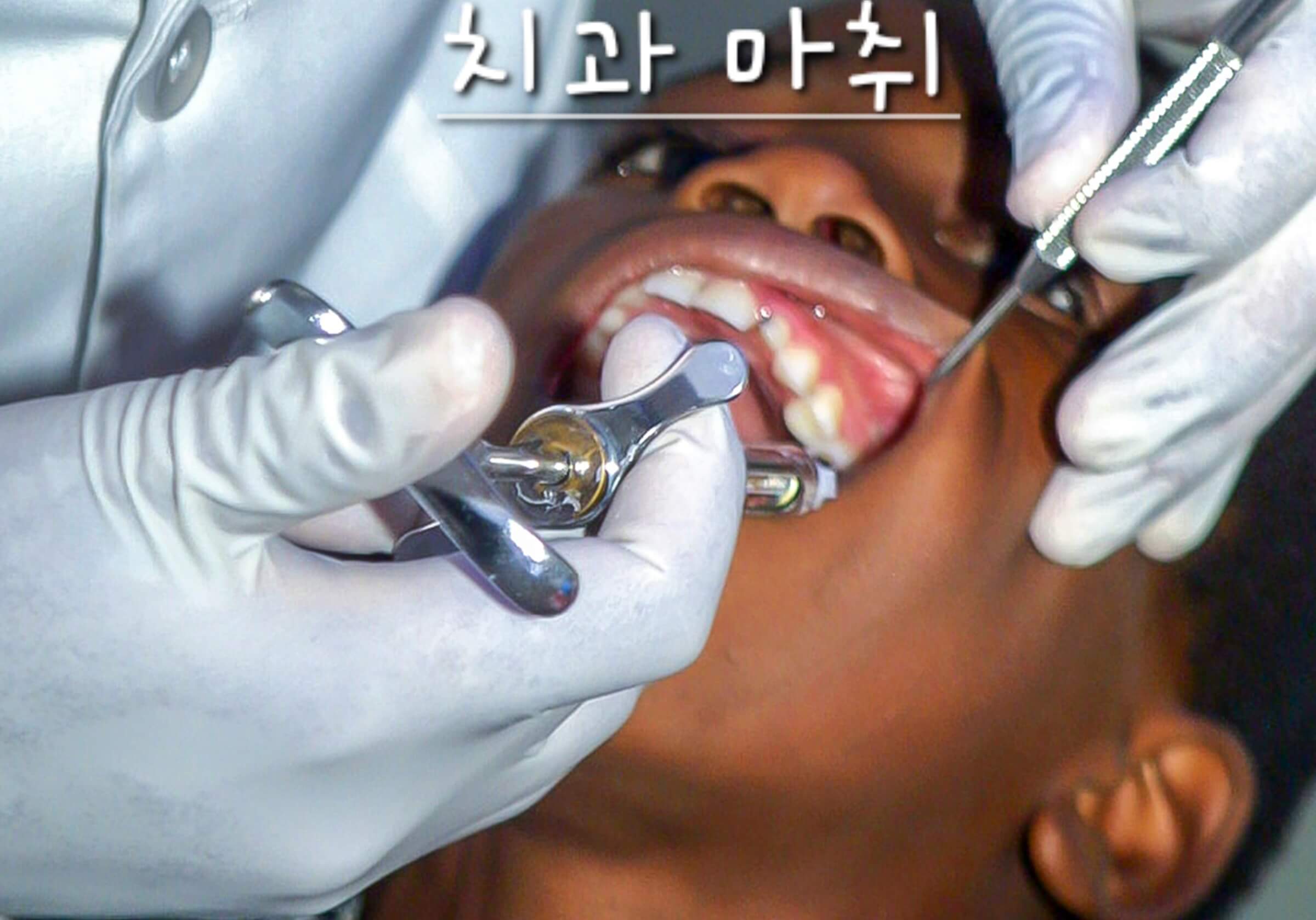 치과 마취
