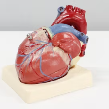 고지혈증 증상 원인 예방법 음식