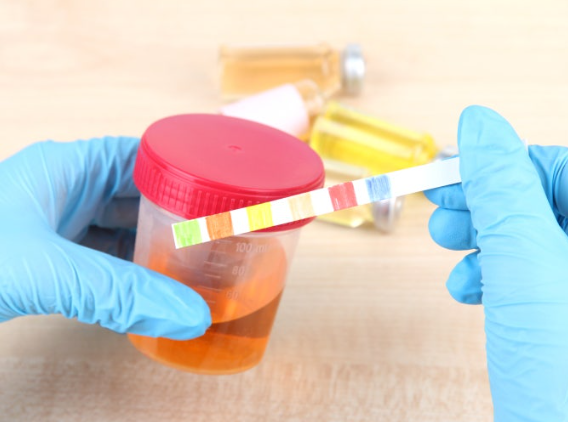 소변이 붉어지는 현상