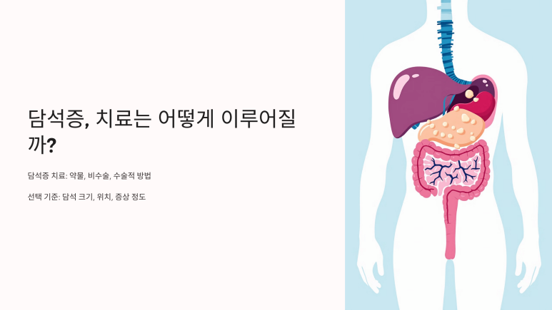 담석증 치료방법