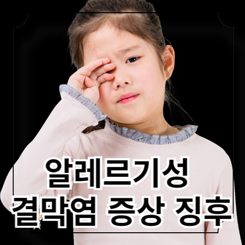 알레르기성 결막염 증상