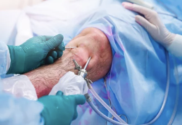 무릎 연골 치료 사진