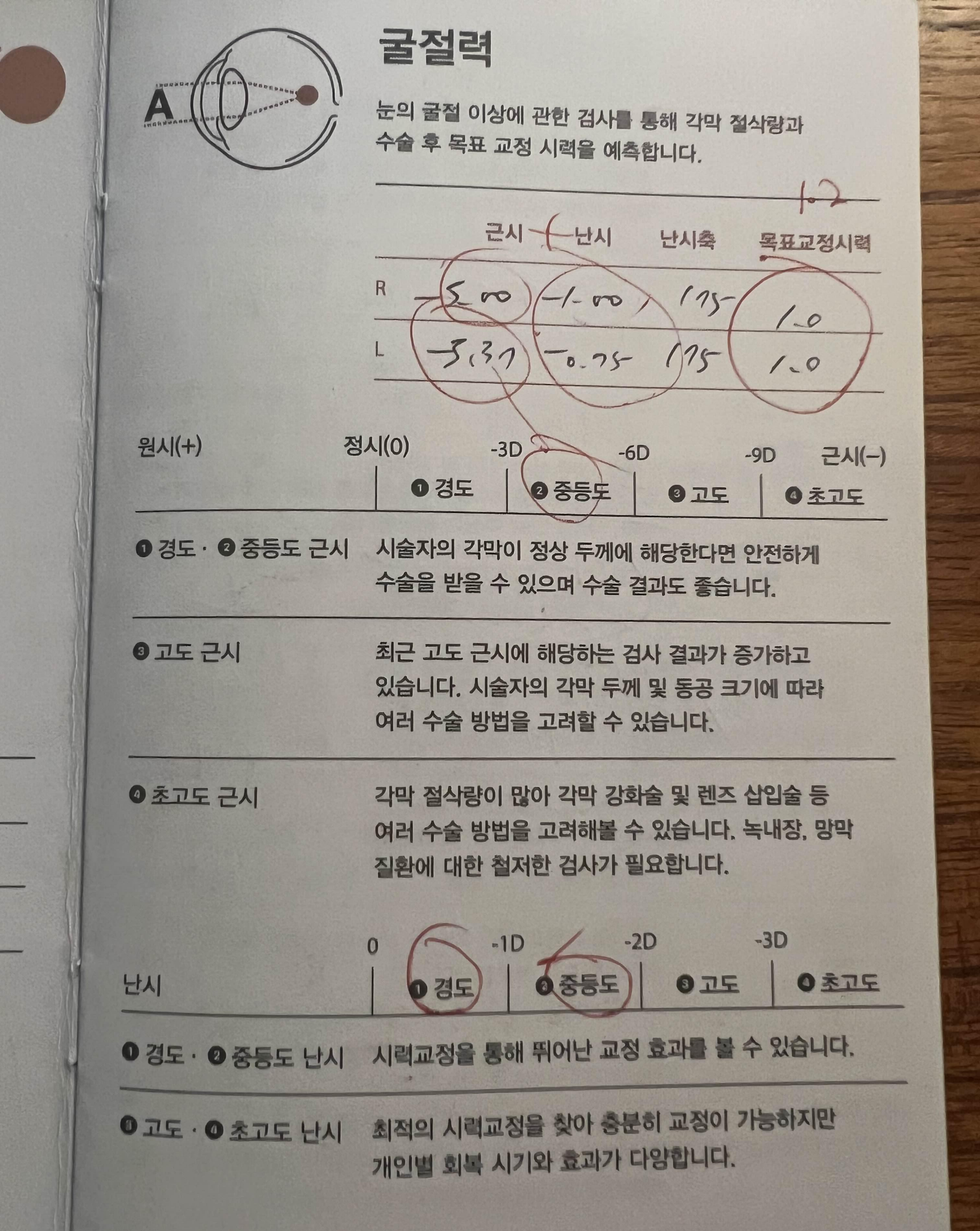 라식 사전 검사