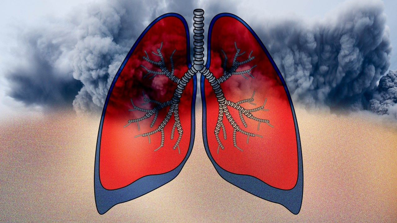 미세먼지 최악, 건강한 호흡법