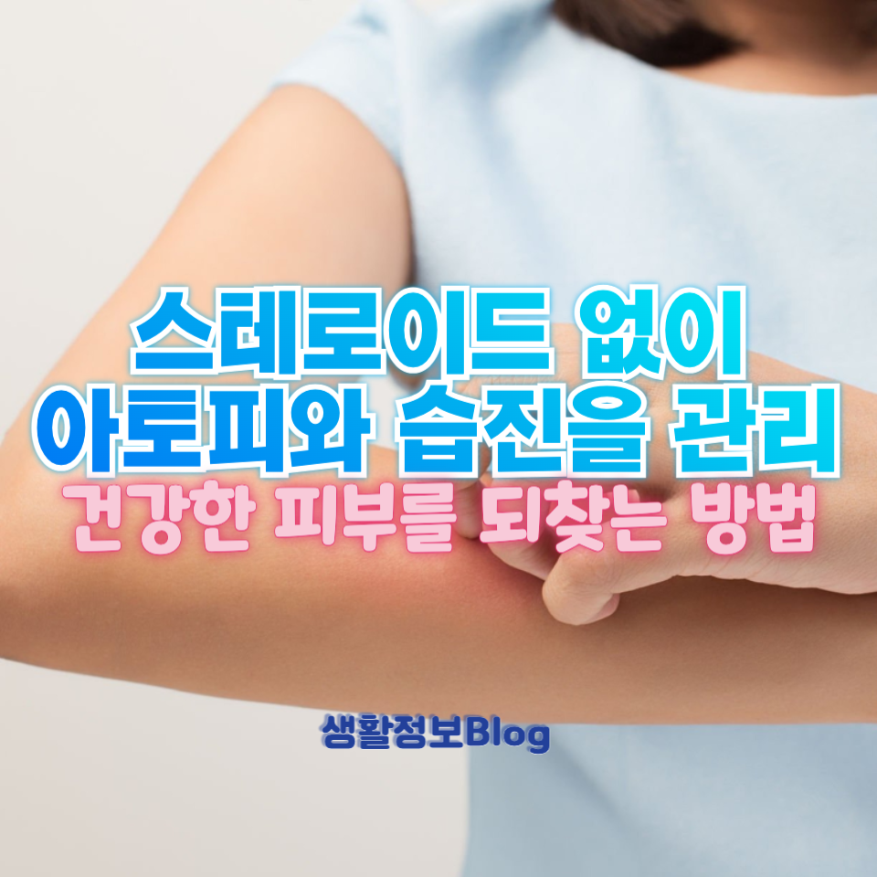 스테로이드 없이 아토피와 습진을 관리