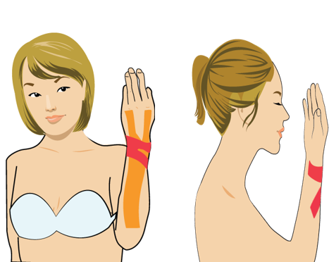 류마티스를 동반한 손목 통증