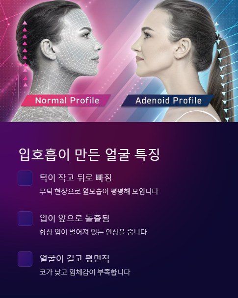 입호흡이 만든 얼굴 특징