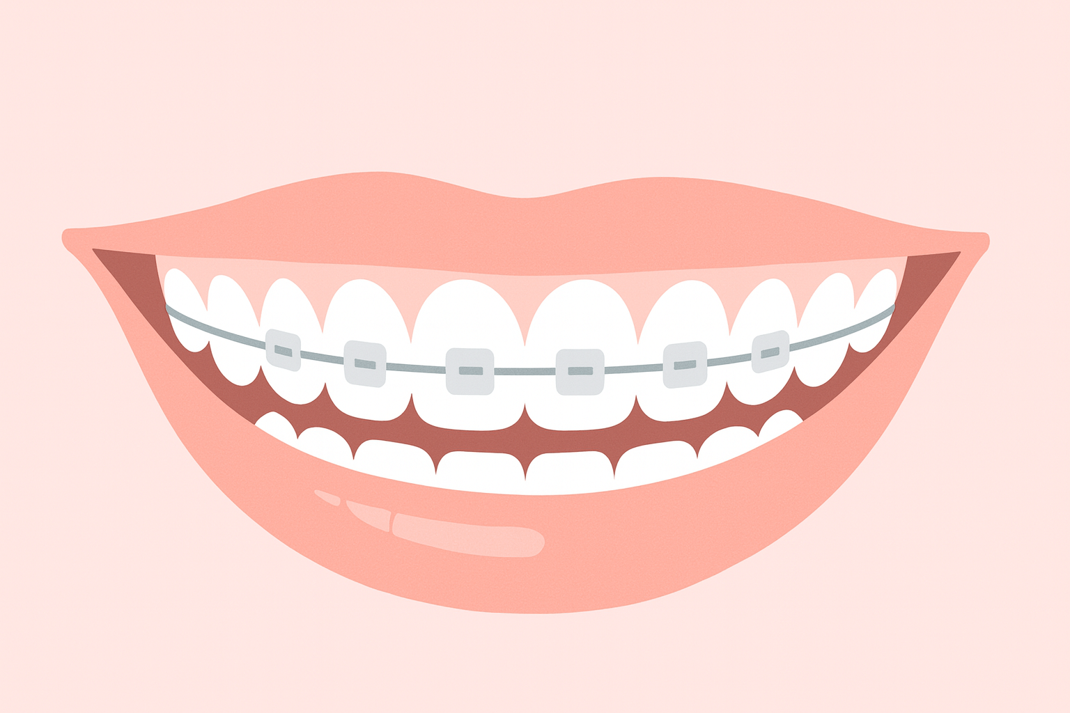 부정교합 교정장치 종류별 효과와 단점 총정리