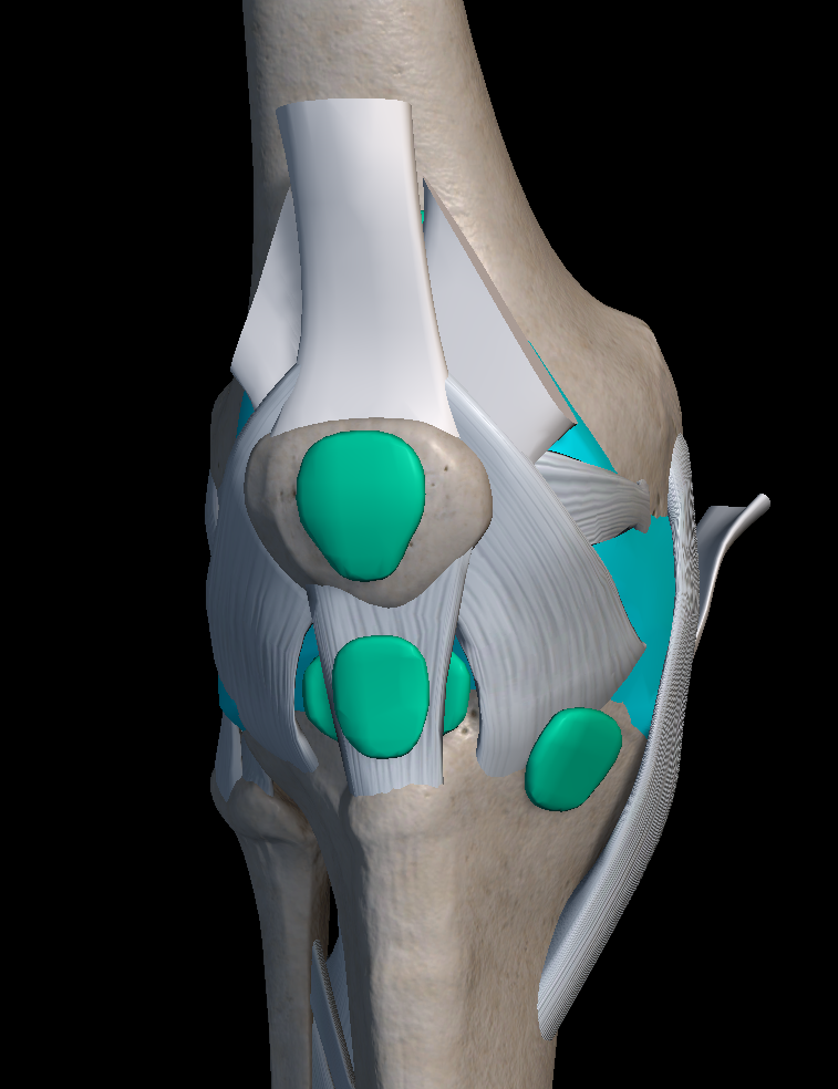 무릎 인대 파열 원인