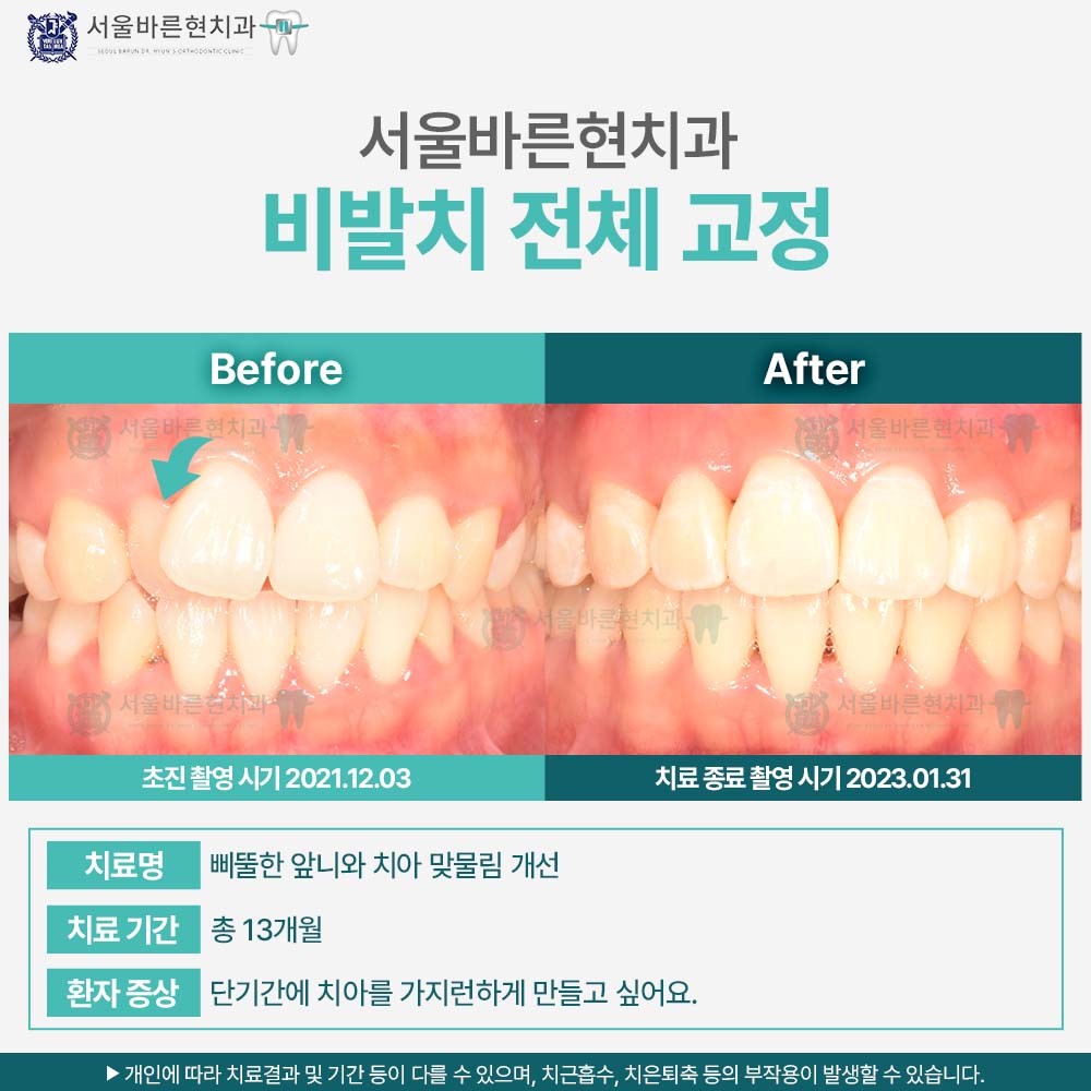 해운대치아교정