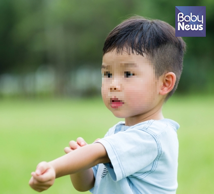 선상태선 증상 원인 레이저 얼굴 다리 연고 흉터 전염 아기 치료방법