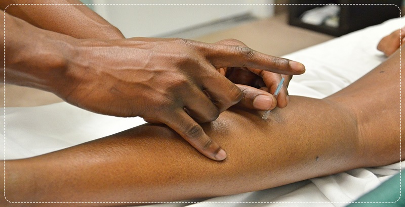 팔에 침 놓는 사진