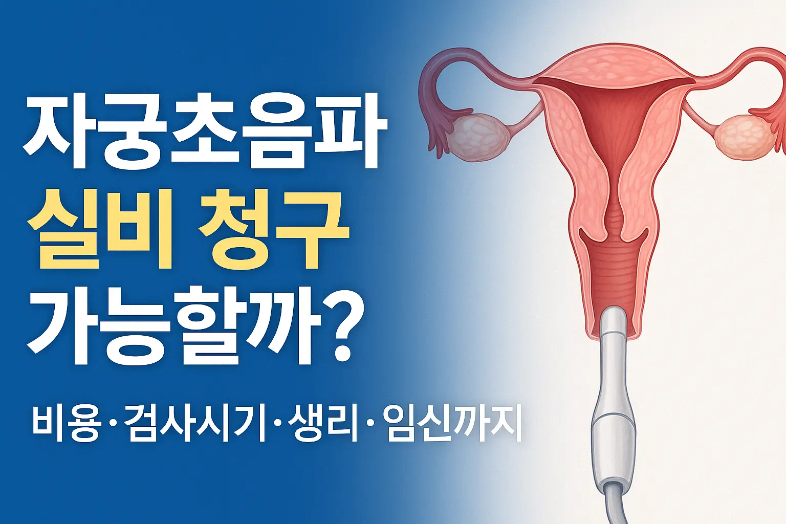 자궁초음파-실비-청구-비용-검사시기-생리-임신-썸네일