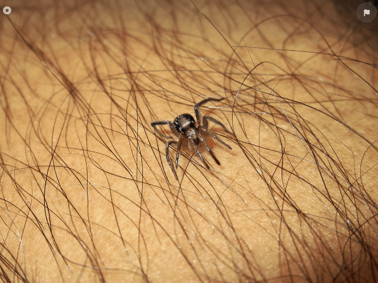 인체에 붙어 있는 진드기