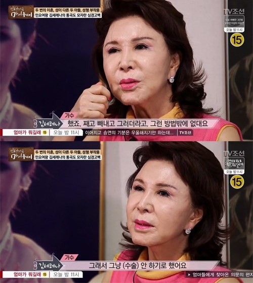 김세레나 성형 얼굴