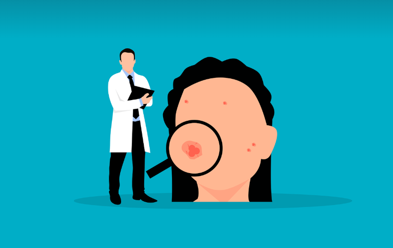 피부질환의 원인과 종류, 예방 및 관리 방법