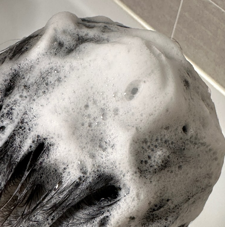 리맨틱 리바이브 탈모 앰플 리얼 내돈내산 후기