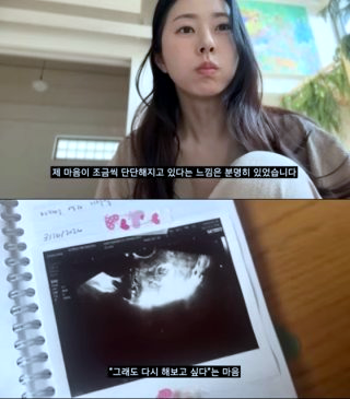 서동주 계류유산 서세원 서정희 딸 프로필
