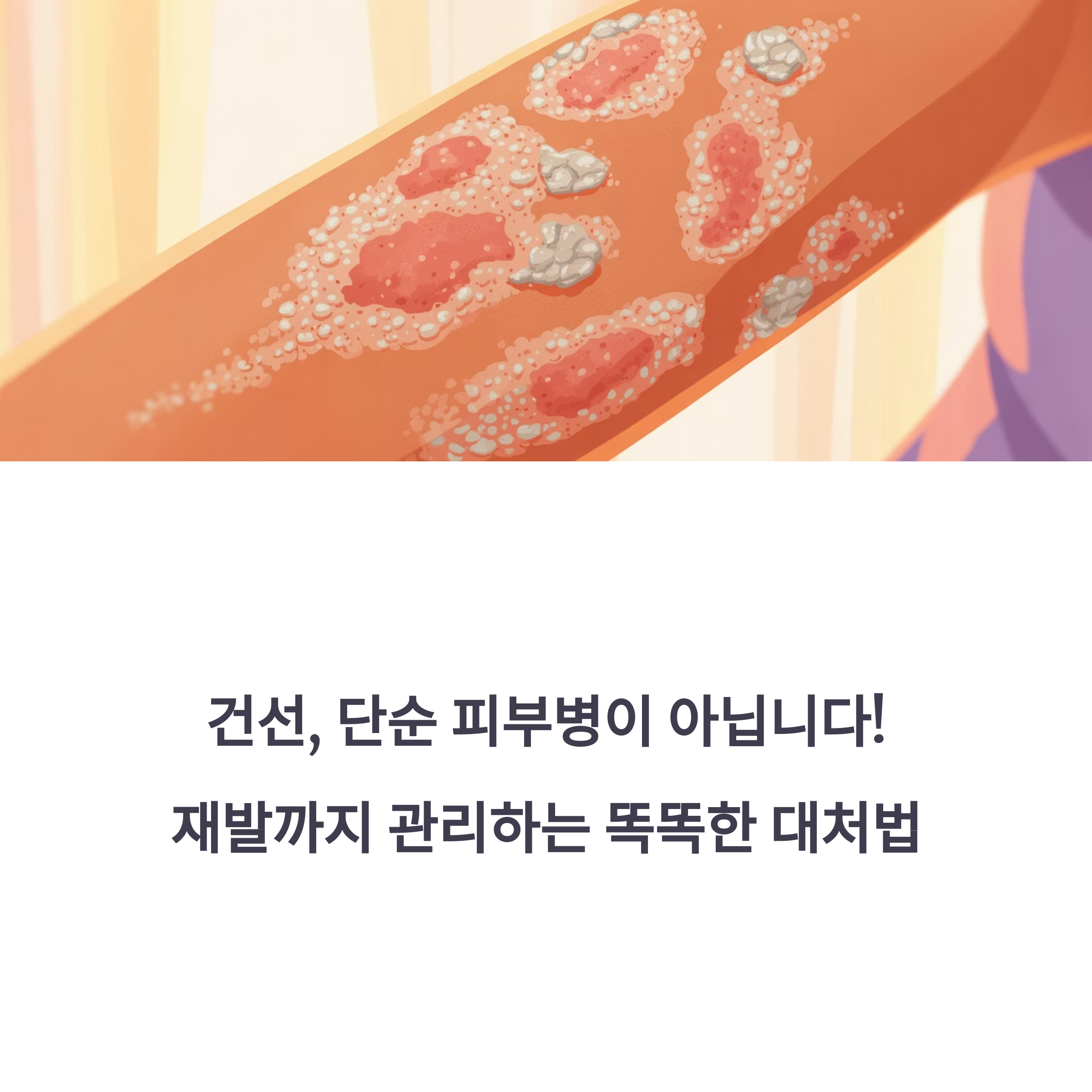 팔 피부에 발생한 건선 병변을 묘사한 일러스트와 함께 질환 인식을 돕는 메시지 포함 이미지