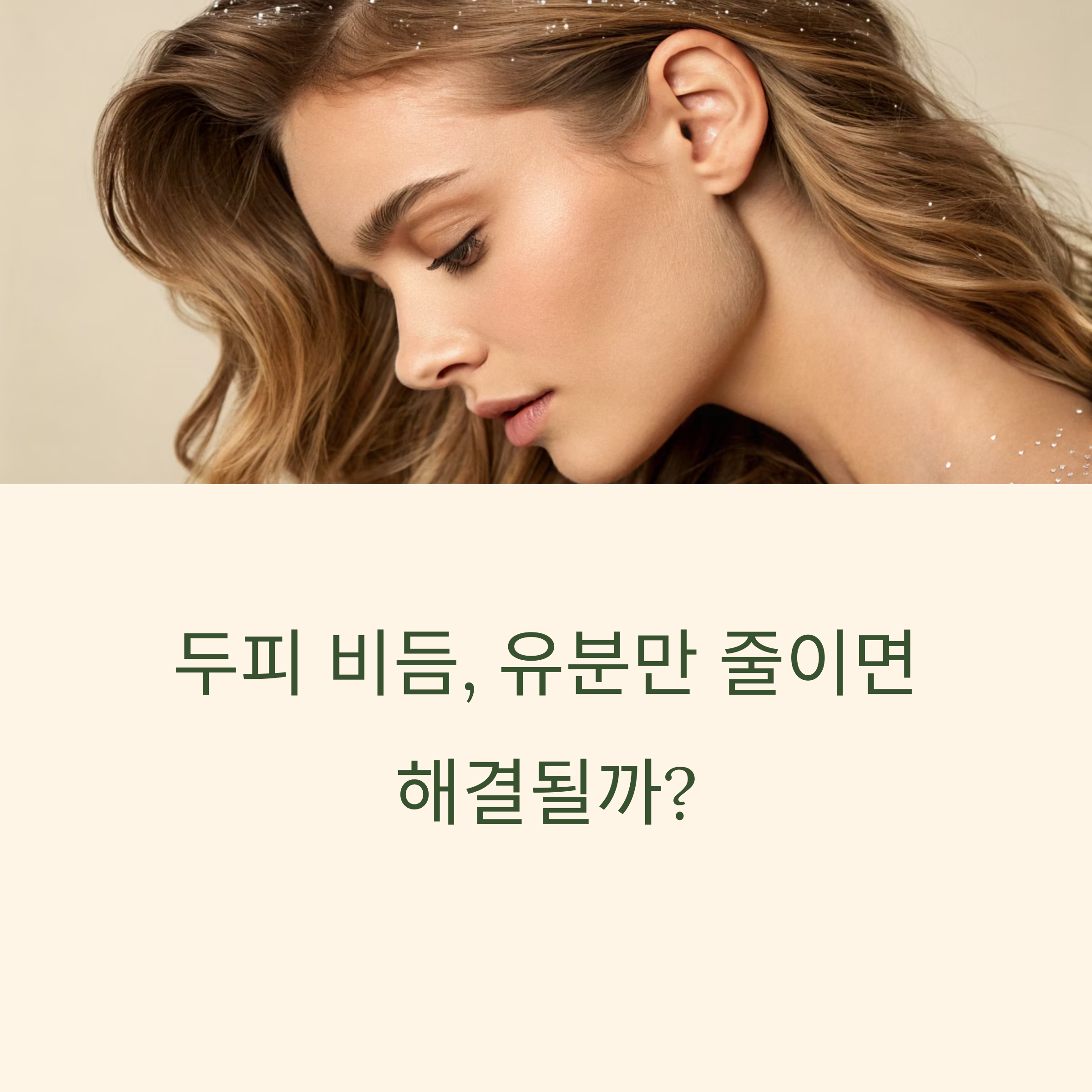 두피비듬