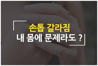 손톱의 상태는 건강 가늠자