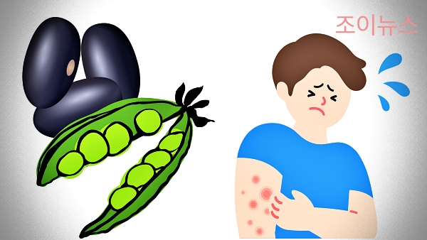 대두 식품알레르기 증상
