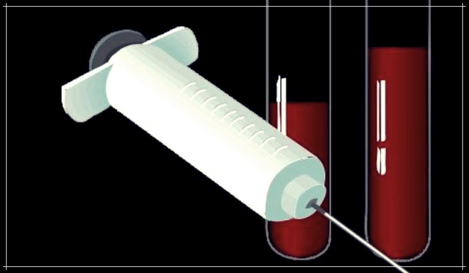 인슐린 펌프: 가격, 종류 및 시술 병원