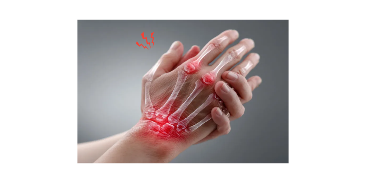 방아쇠수지증후군