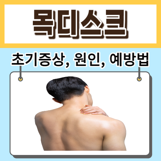 목디스크-초기증상-원인-예방법