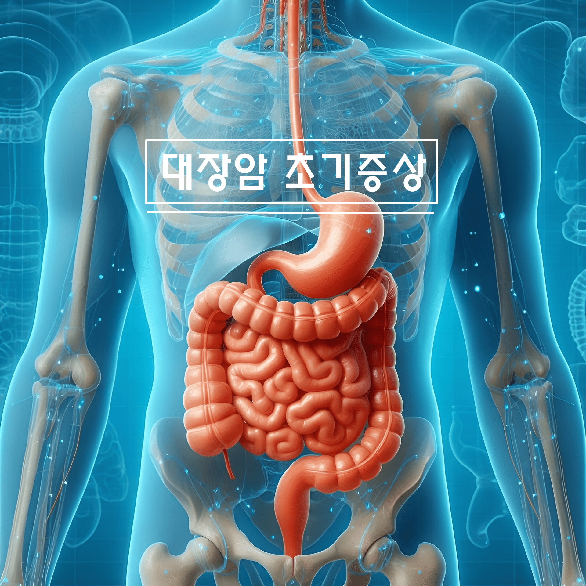 대장암 초기증상 사진