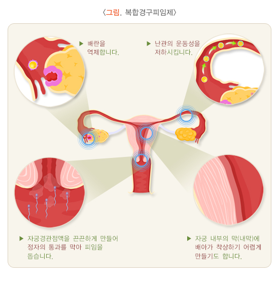 사후_피임약_작동방식