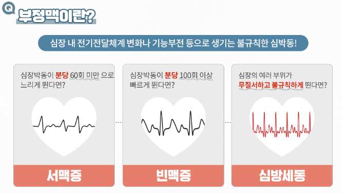 부정맥 증상