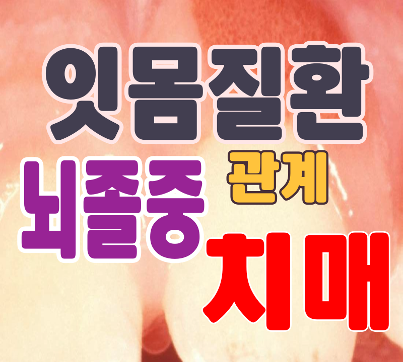 뇌졸중_치매_치주질환 관계