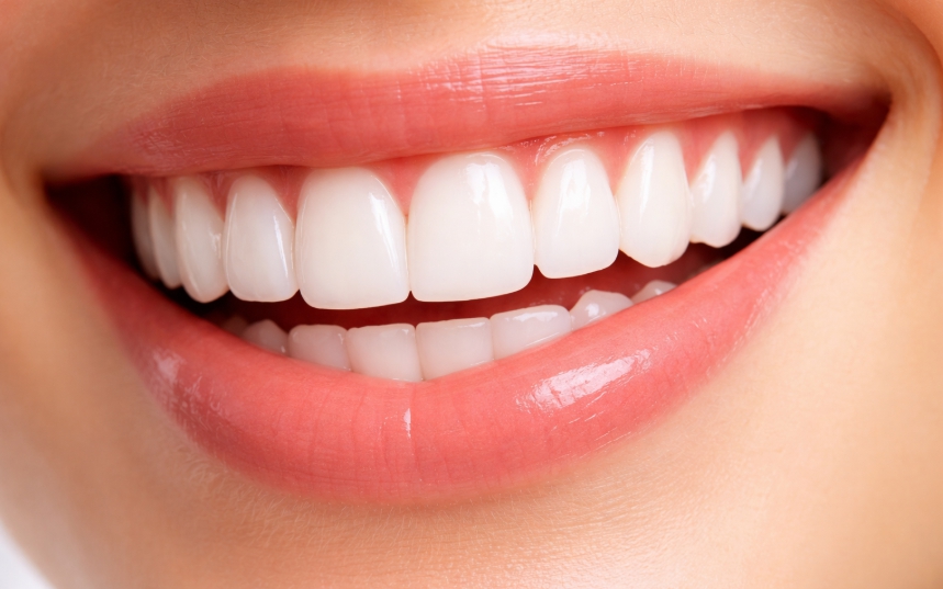 건강한 잇몸 치아사진