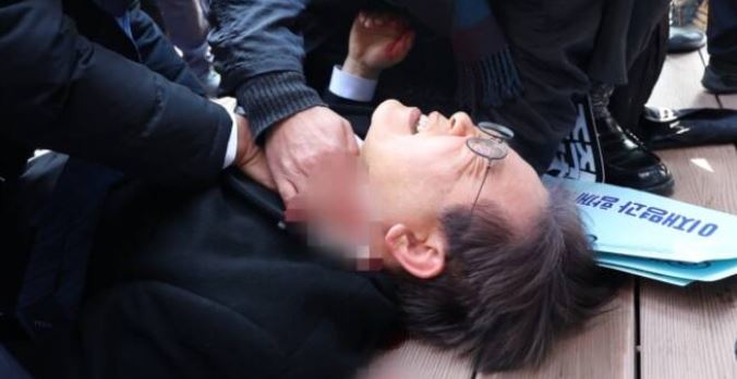 이재명 피습, 특혜 논란