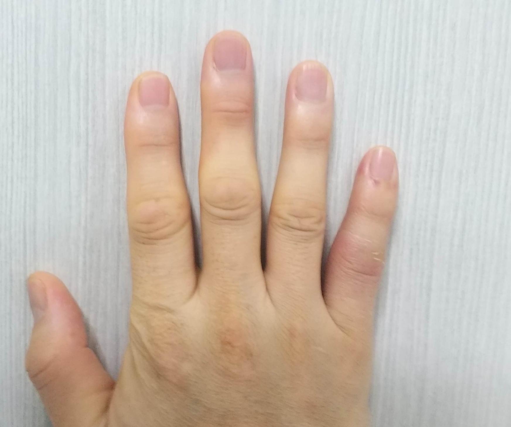 재활치료중구부림정도확인사진