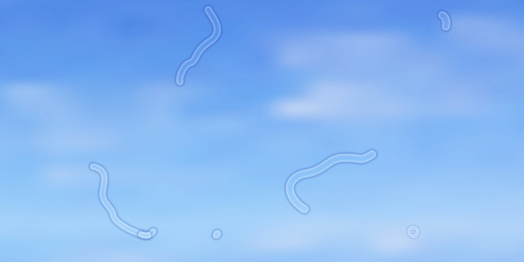 비문증-실지렁이